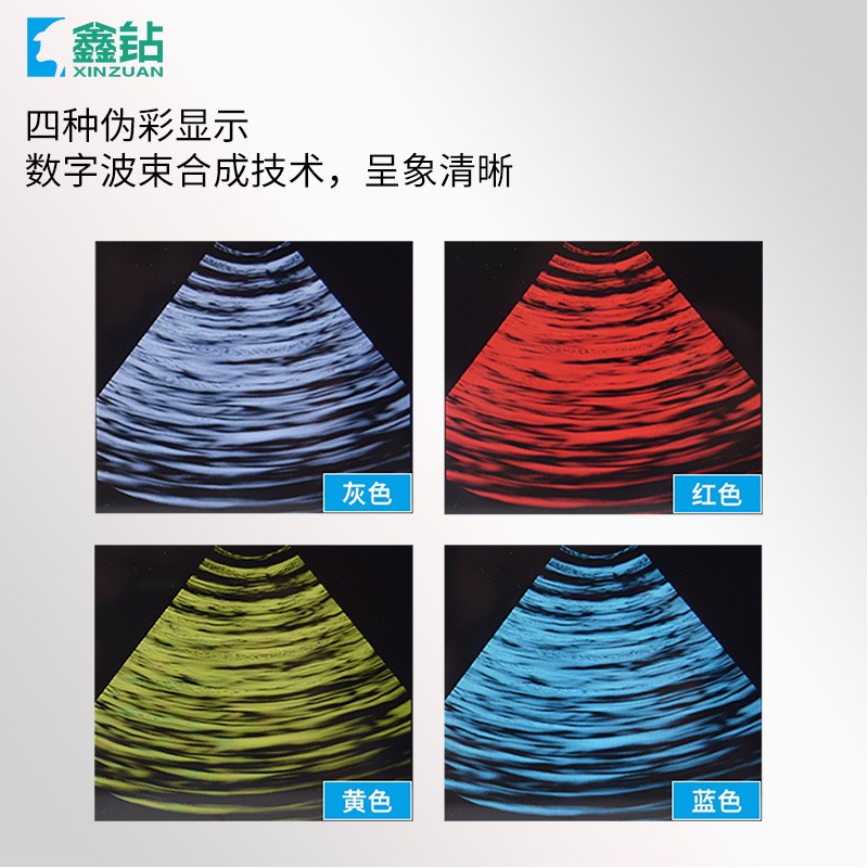 【鑫钻】兽用B超A71 便携兽用B超 动物B超 兽用超声诊断仪图4