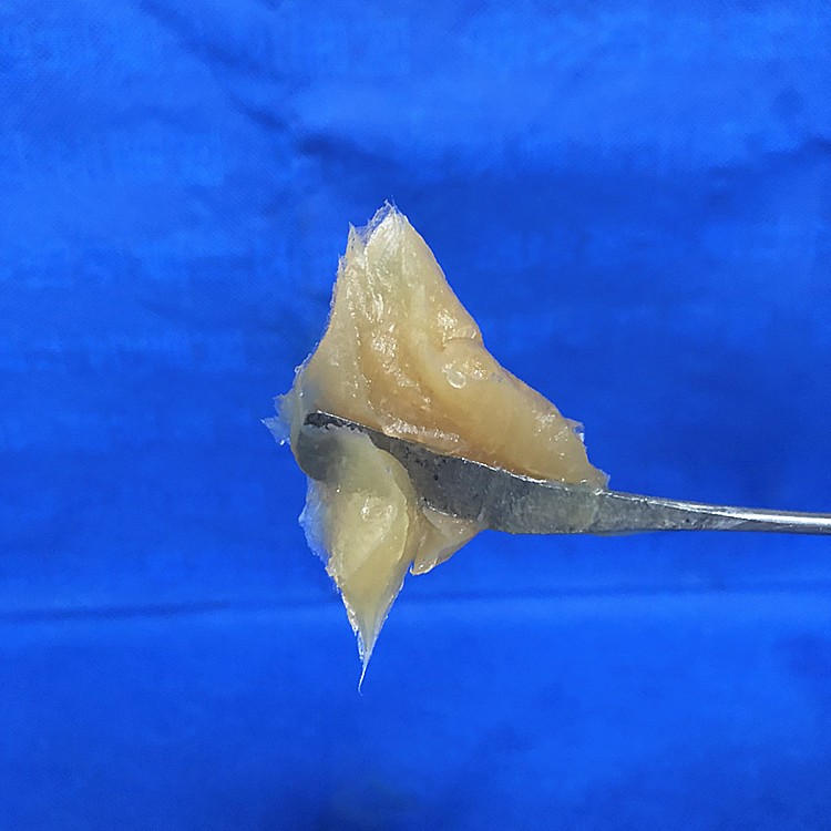 多功能锂基润滑脂图2